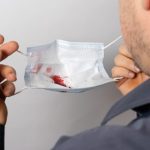 Penyebab Batuk Berdarah Dan Cara Diagnosisnya