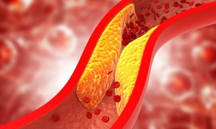 Gaya Hidup Sehat Untuk Menjaga Kolesterol Normal Secara Alami