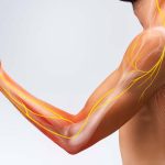 Tanda Saraf Kejepit Yang Sering Diabaikan