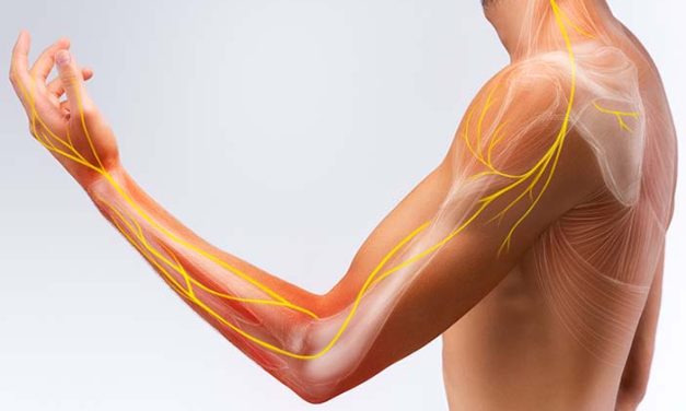 Tanda Saraf Kejepit Yang Sering Diabaikan