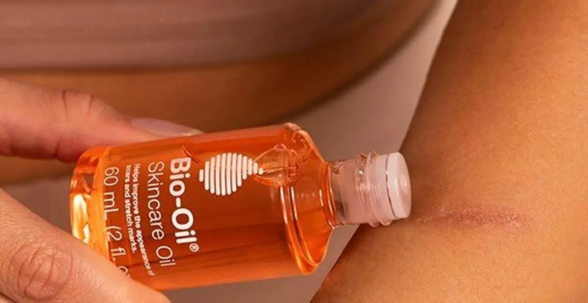 Bio Oil: Kegunaan Produk Perawatan Kulit Dan Cara Pemakaian